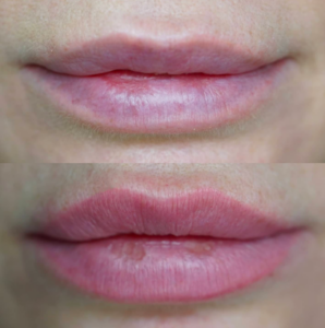 lips14