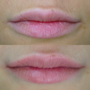 lips23