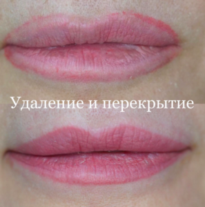 lips28