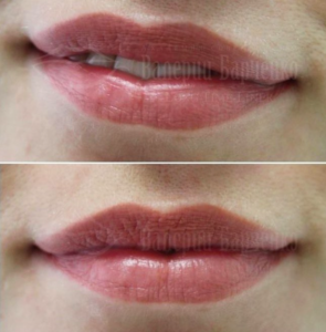 lips32