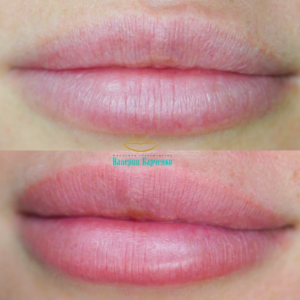 lips33